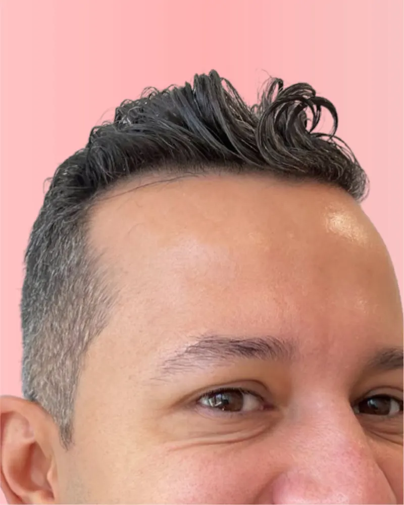 Después